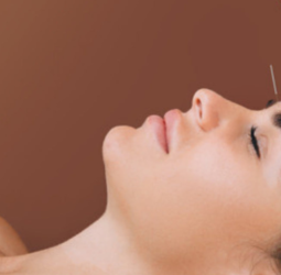 Acupuncture: Ancient Wisdom for Modern Wellness