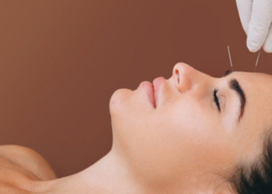 Acupuncture: Ancient Wisdom for Modern Wellness