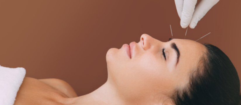 Acupuncture: Ancient Wisdom for Modern Wellness