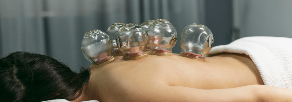 Cupping Therapy: Unveiling the Benefits