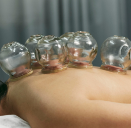 Cupping Therapy: Unveiling the Benefits