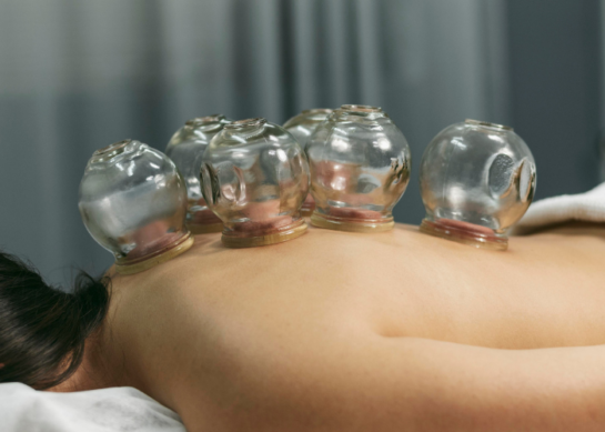 Cupping Therapy: Unveiling the Benefits