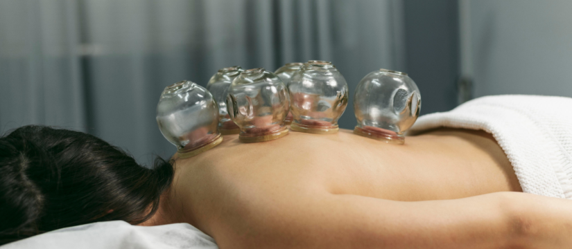 Cupping Therapy: Unveiling the Benefits